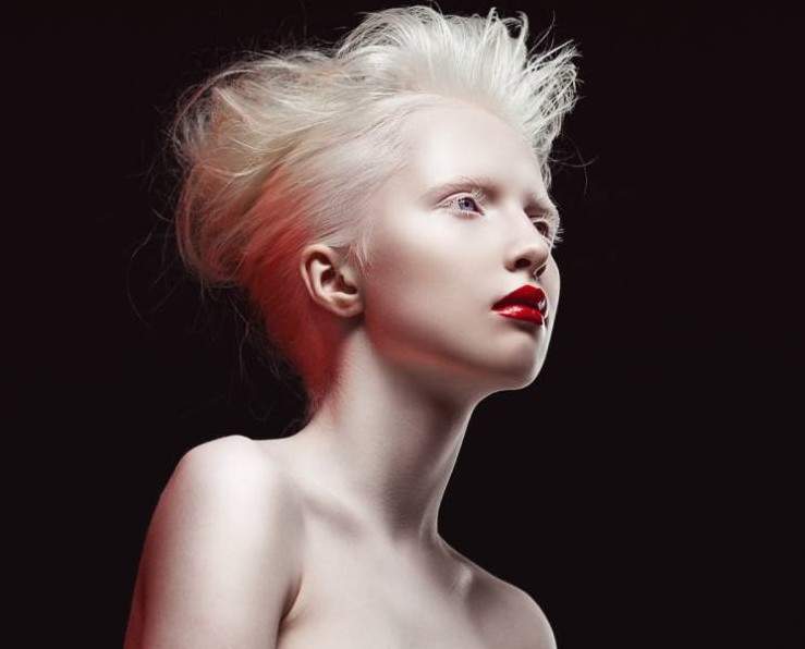 Российская красивая девушка модель альбинос